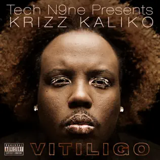 Krizz Kaliko – Vitiligo Krizz Kaliko – Vitiligo