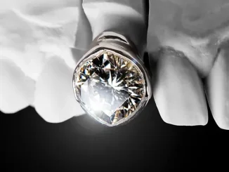 Post Malone The Diamond Collection (Deluxe)
